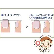 正しい爪の切り方