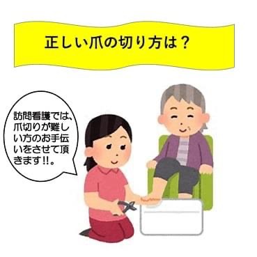 正しい爪の切り方